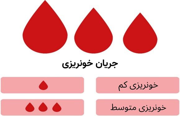 سرریز شدن